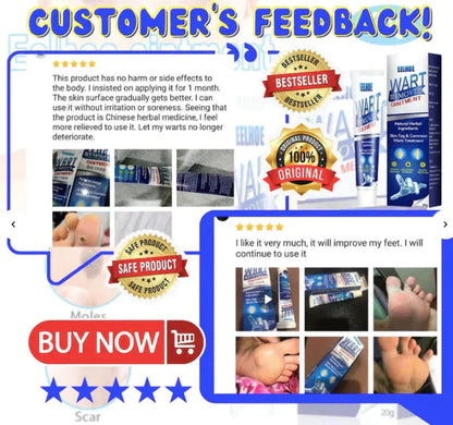 Instant Wart Removal Cream - 100g [ BUY 1 GET 1 FREE]